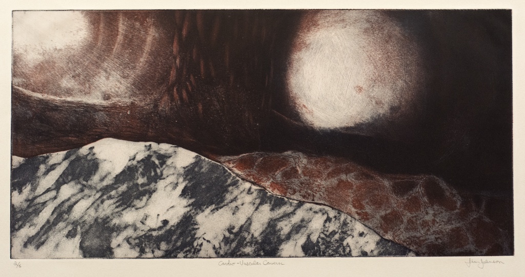 Cardio-vascular cavern